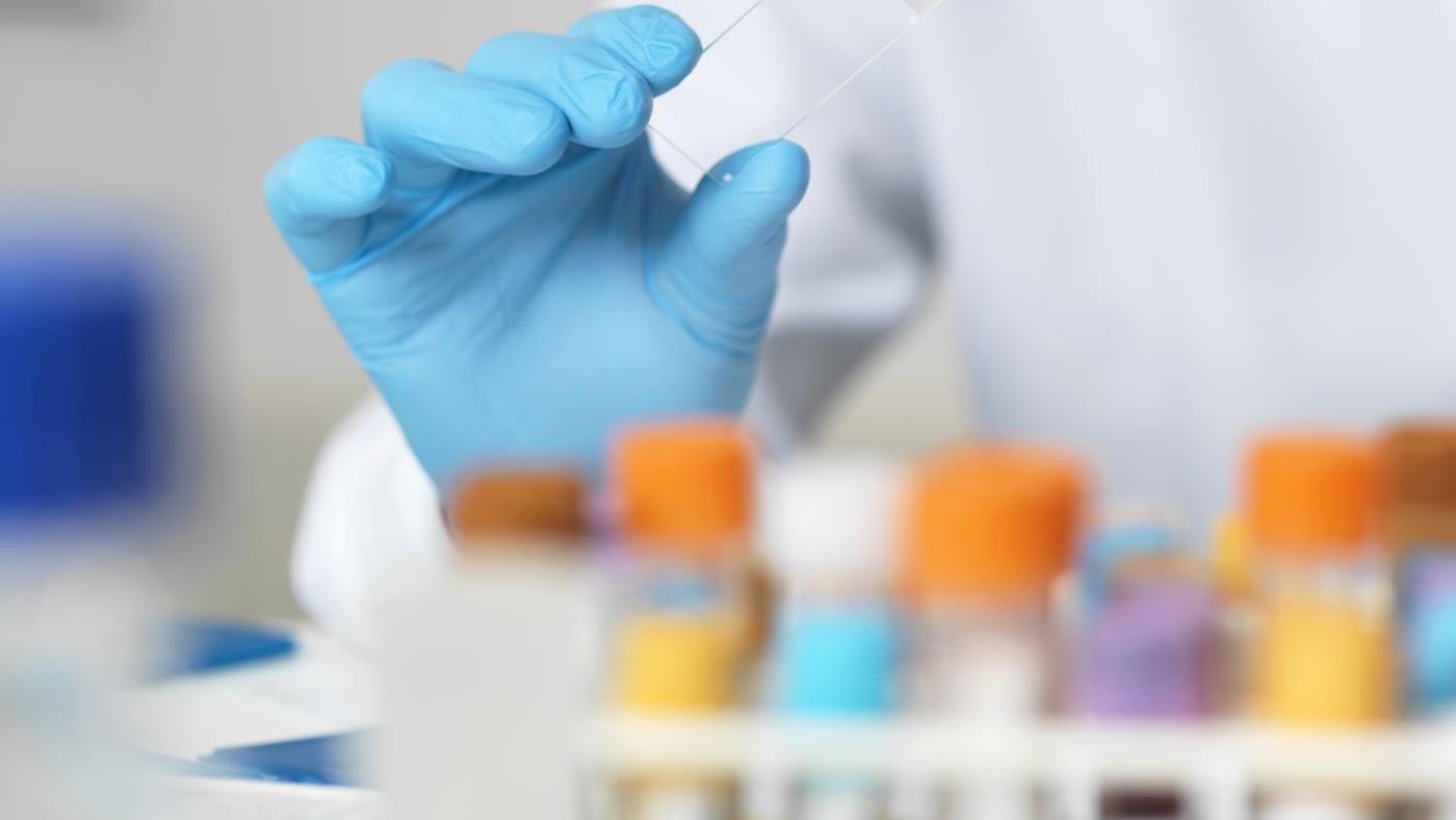 What Blood Tests Require a Patient to Fast Beforehand?