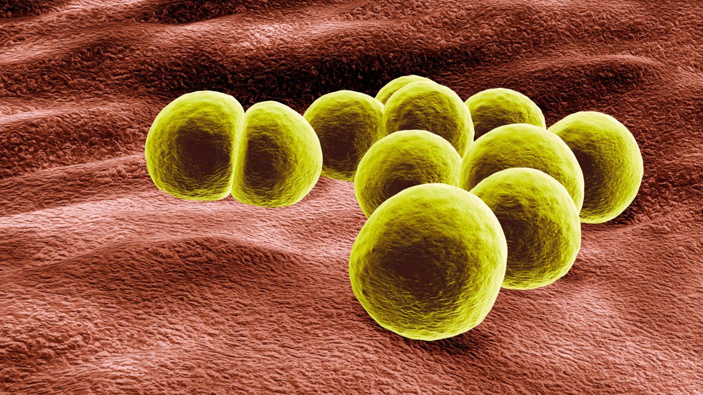 What Does MRSA Stand For?
