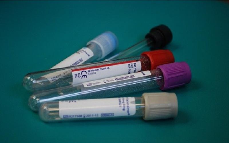 What Does a High MPV in Blood Mean?